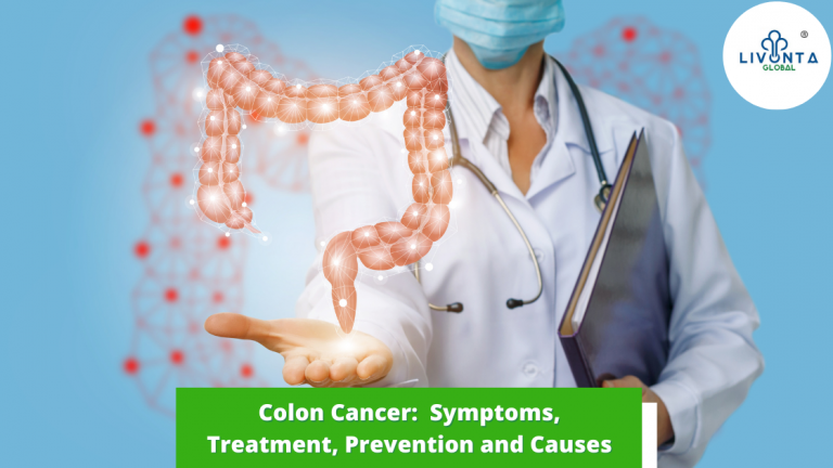 colon cancer symptoms treatment
