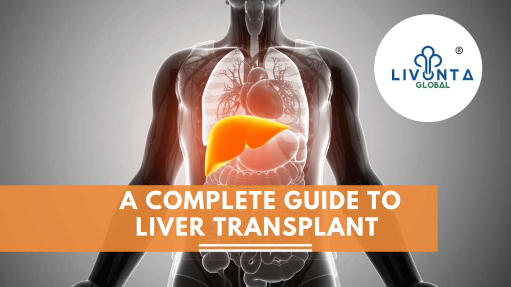 A Complete Guide To Liver Transplant And Its Procedure - Livonta Global ...