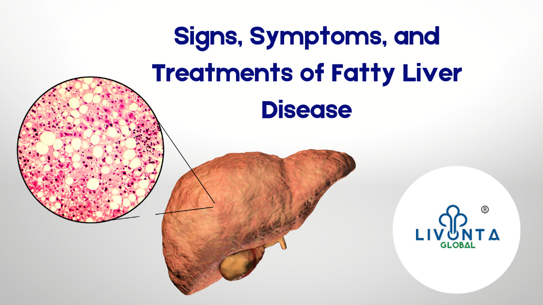 Signs Symptoms And Treatments Of Fatty Liver Disease Livonta Global