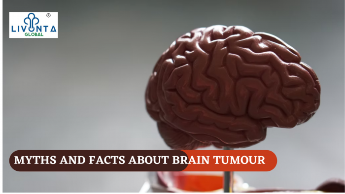 Myths And Facts About Brain Tumour Livonta Global Pvt Ltd