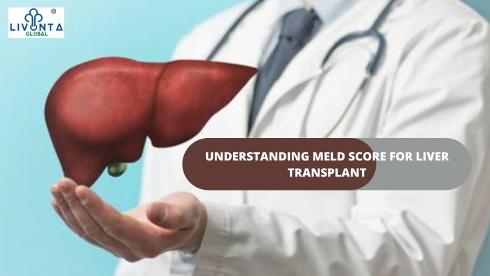 UNDERSTANDING MELD SCORE FOR LIVER TRANSPLANT - Livonta Global Pvt Ltd