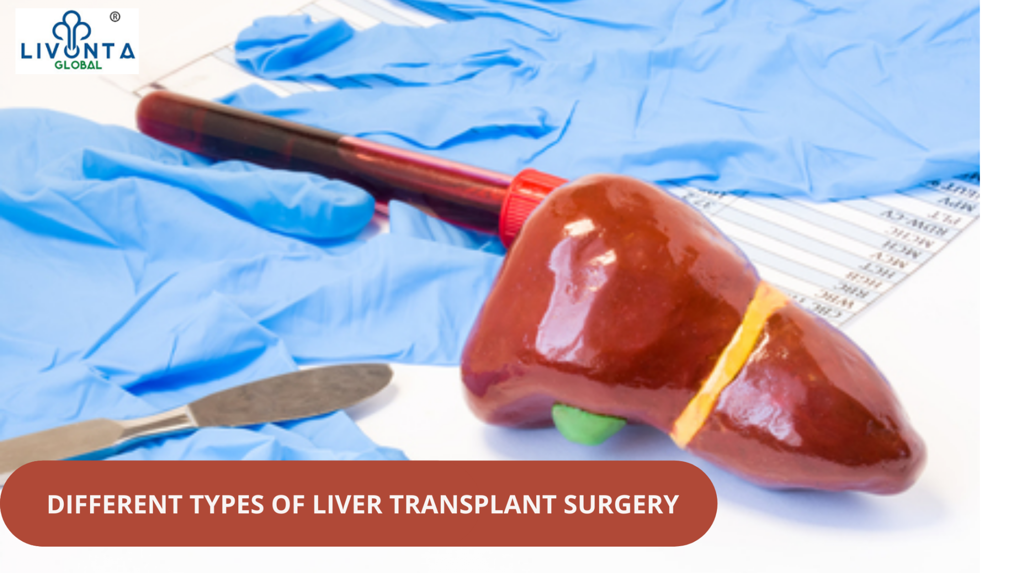 Different Types Of Liver Transplant Surgery Livonta Global Pvt Ltd 3602