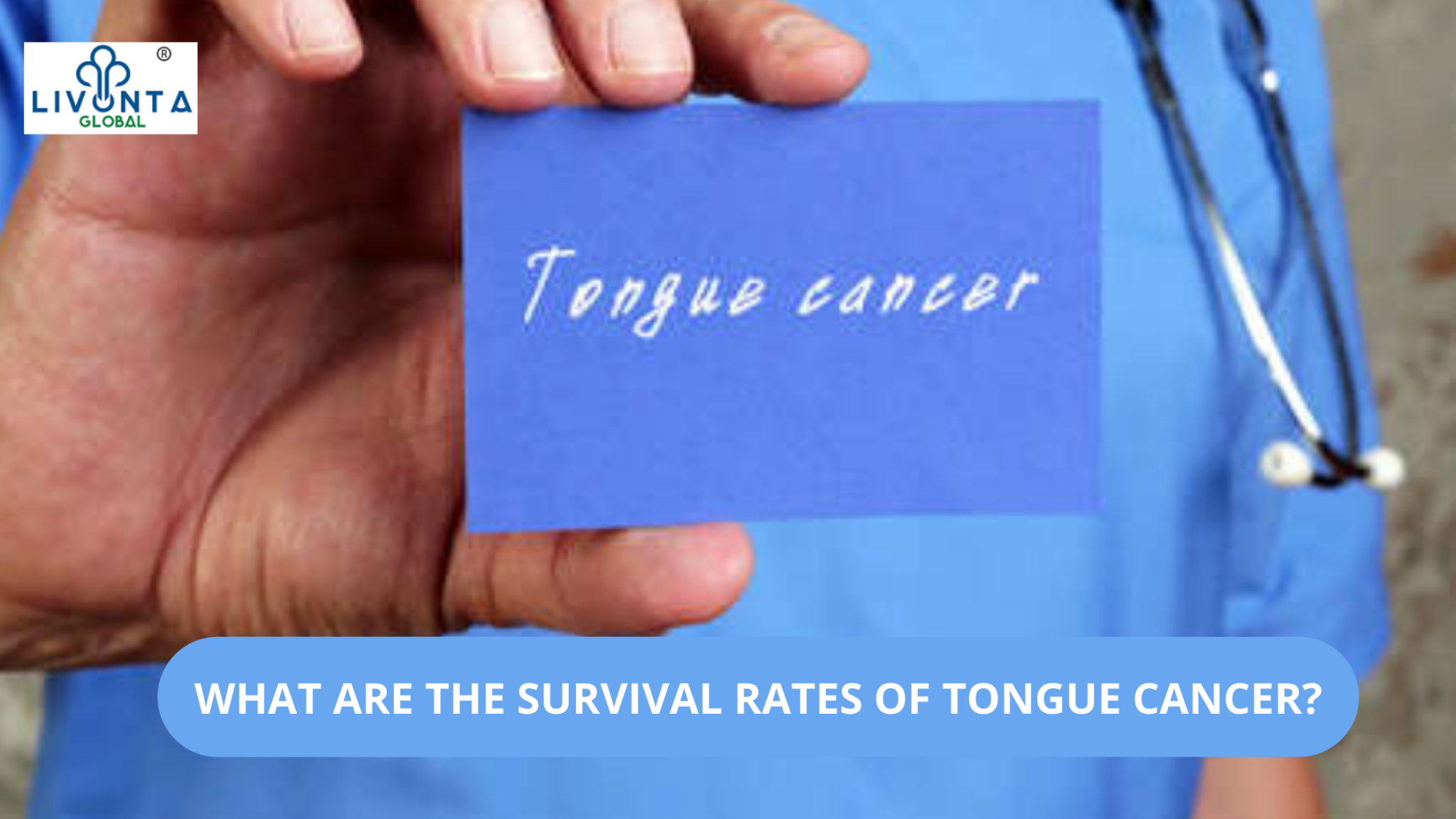 what-are-the-survival-rates-of-tongue-cancer-livonta-global-pvt-ltd