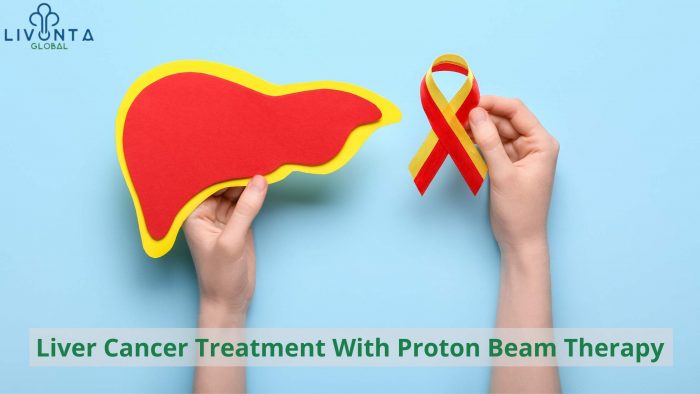 Liver Cancer Treatment With Proton Beam Therapy - Livonta Global Pvt Ltd