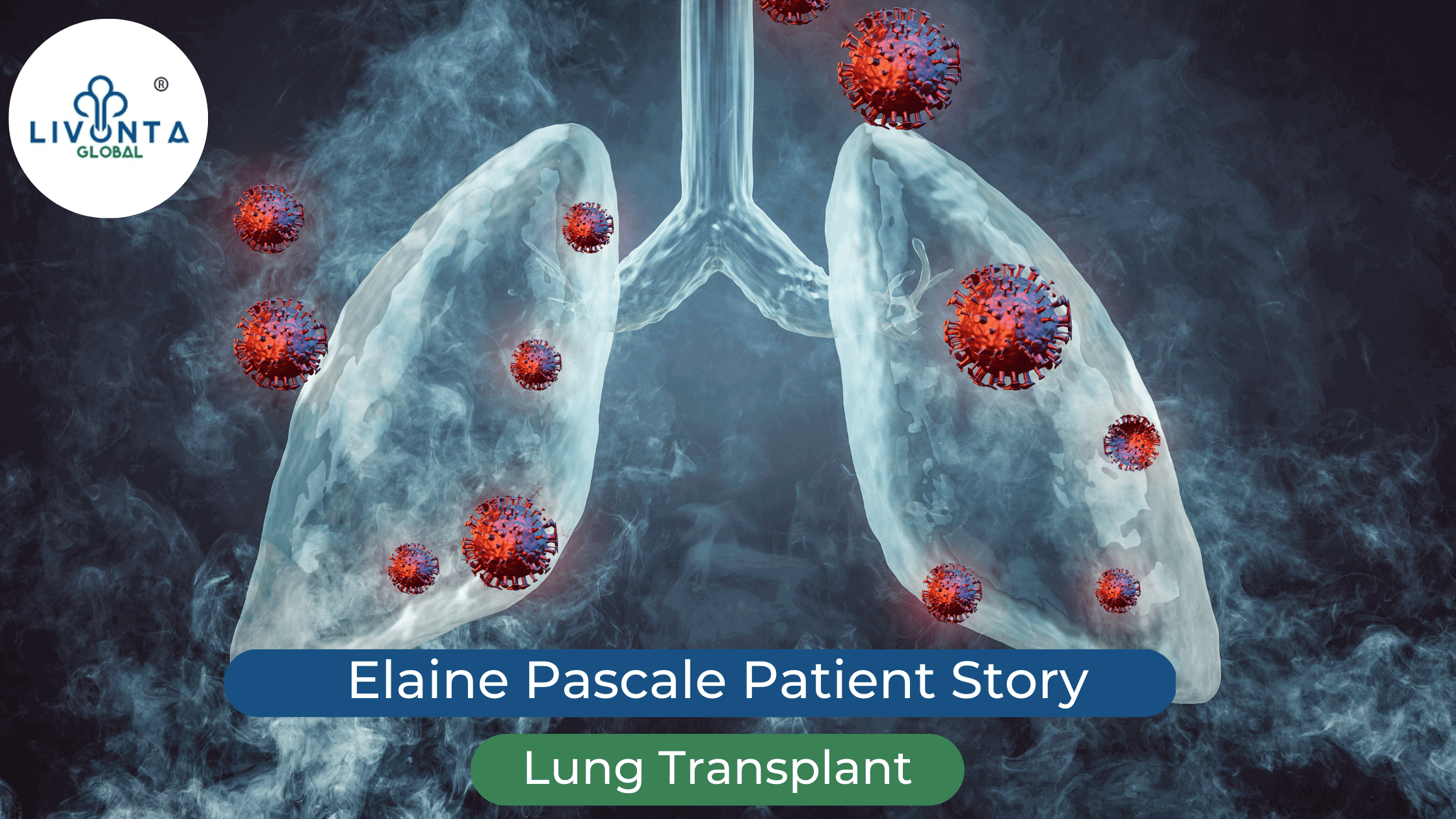 Elaine Pascale Patient Story